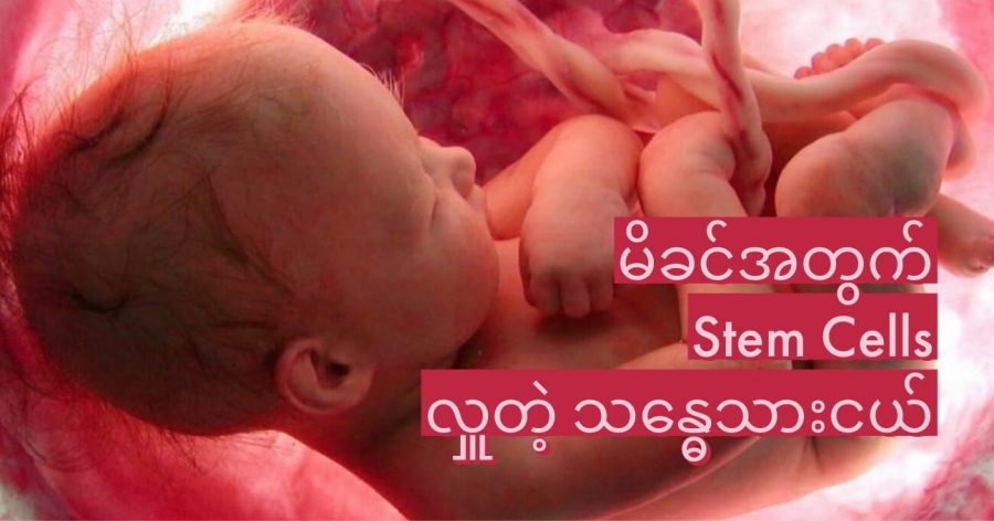 မိခင်အတွက် Stem Cells လှူတဲ့ သန္ဓေသားငယ်