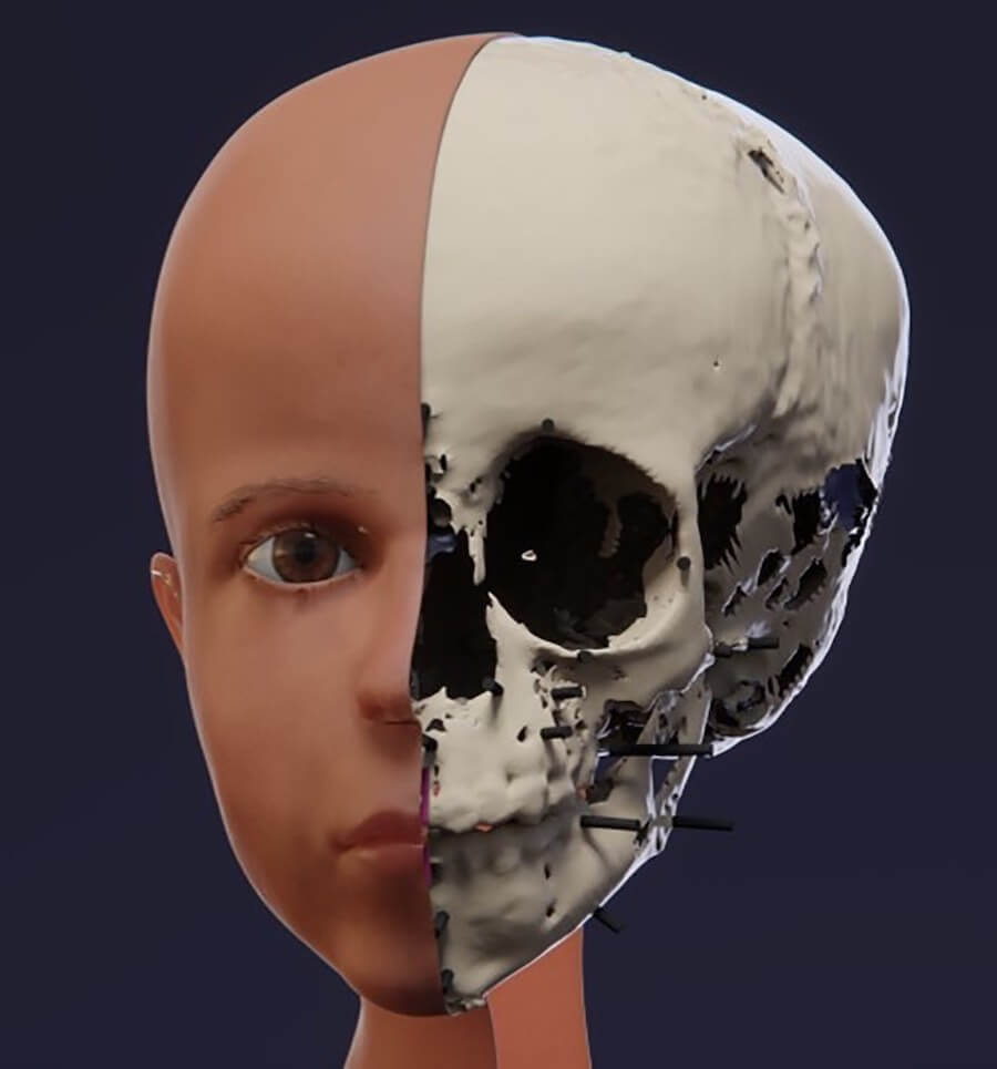 Egyptian boy's facial reconstruction